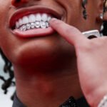 Pessoa com cabelo trançado usa terno preto, gravata borboleta preta com brilho e colar de corrente grossa prateada. Dedão aponta para aparelho dental com diamantes nos dentes superiores. Relógio prateado no pulso esquerdo.