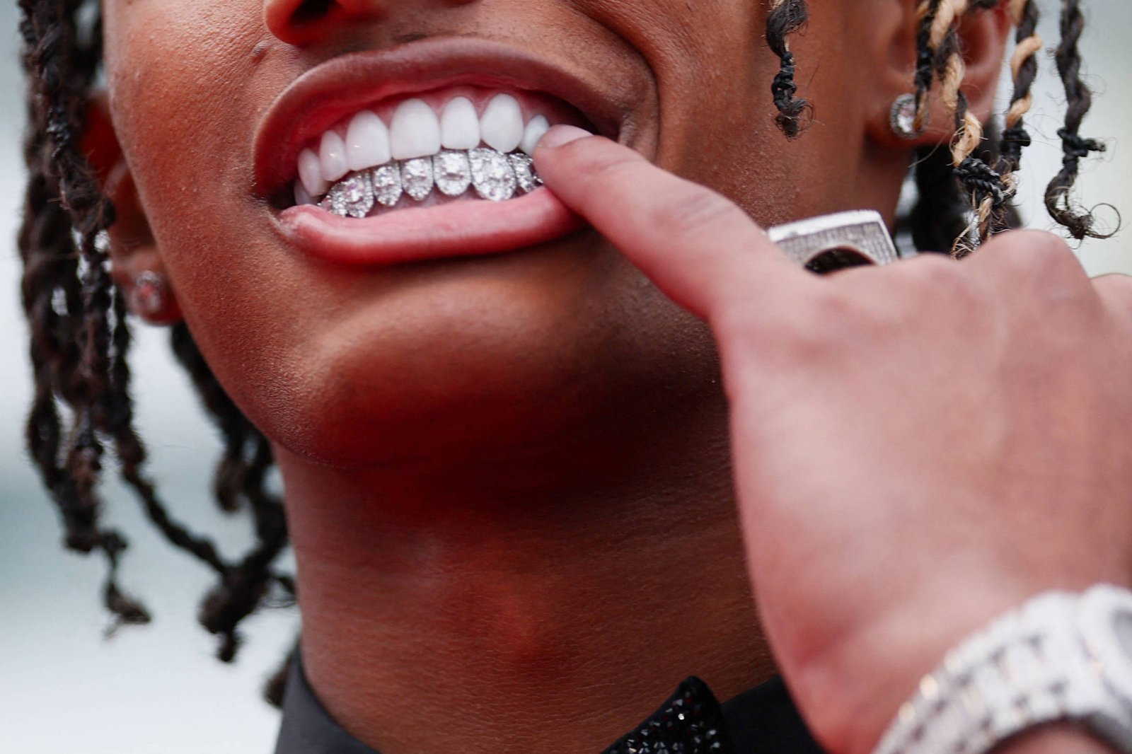 Pessoa com cabelo trançado usa terno preto, gravata borboleta preta com brilho e colar de corrente grossa prateada. Dedão aponta para aparelho dental com diamantes nos dentes superiores. Relógio prateado no pulso esquerdo.