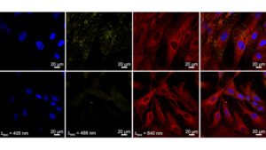 Pesquisadores obtêm avanço em técnica de imagem biomédica e tratamento de câncer