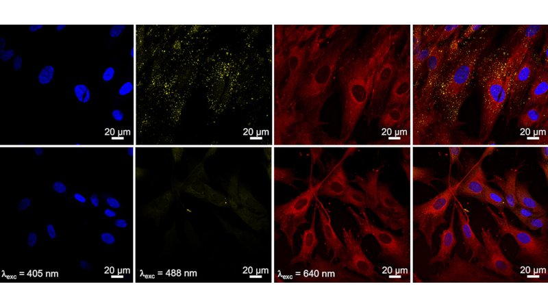Pesquisadores obtêm avanço em técnica de imagem biomédica e tratamento de câncer