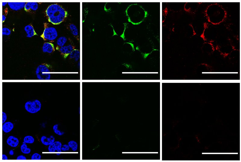 Cientistas usam ultrassom para estourar vírus da influenza A e da COVID-19 sem danificar células humanas