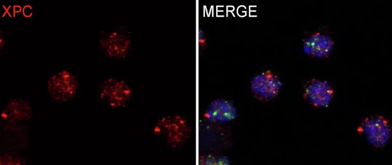 Estudo identifica proteína que protege as células de defesa