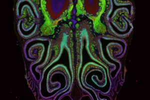 Corte transversal do nariz exibindo estruturas internas em cores fluorescentes. Áreas em verde, azul, roxo e vermelho destacam tecidos e cavidades nasais com padrões simétricos e complexos. Fundo preto realça os detalhes anatômicos.