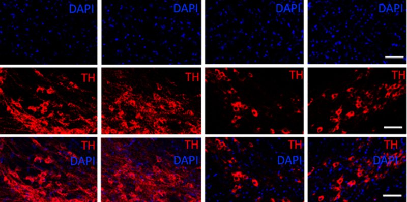 Molécula anti-inflamatória mostra potencial contra Parkinson em estudo com camundongos