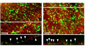 Perda de microbiota altera o perfil das células que protegem a parede do intestino