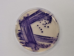 Cientistas descobrem nova toxina usada por bactérias para eliminar rivais