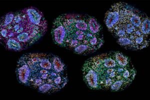 'Minicérebros' de laboratório sobrevivem por cinco anos - 19/08/2026 - Ciência