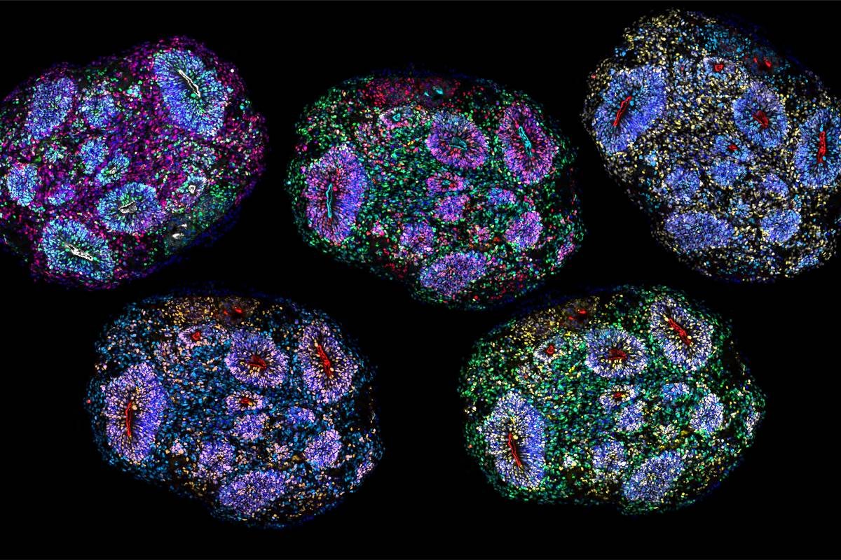 ‘Minicérebros’ de laboratório sobrevivem por cinco anos – 19/08/2026 – Ciência