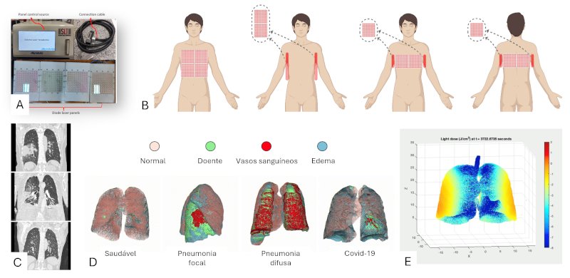 ‘Gêmeo digital’ do tórax simula aplicação de luz para tratamento de pneumonias