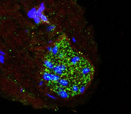 Estrutura que controla a pressão arterial também age como ‘radar’ de inflamação