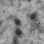 Imagem em escala nanométrica mostra múltiplos bacteriófagos com cabeças hexagonais e caudas longas sobre uma superfície granular. Escala indica 200 nanômetros.