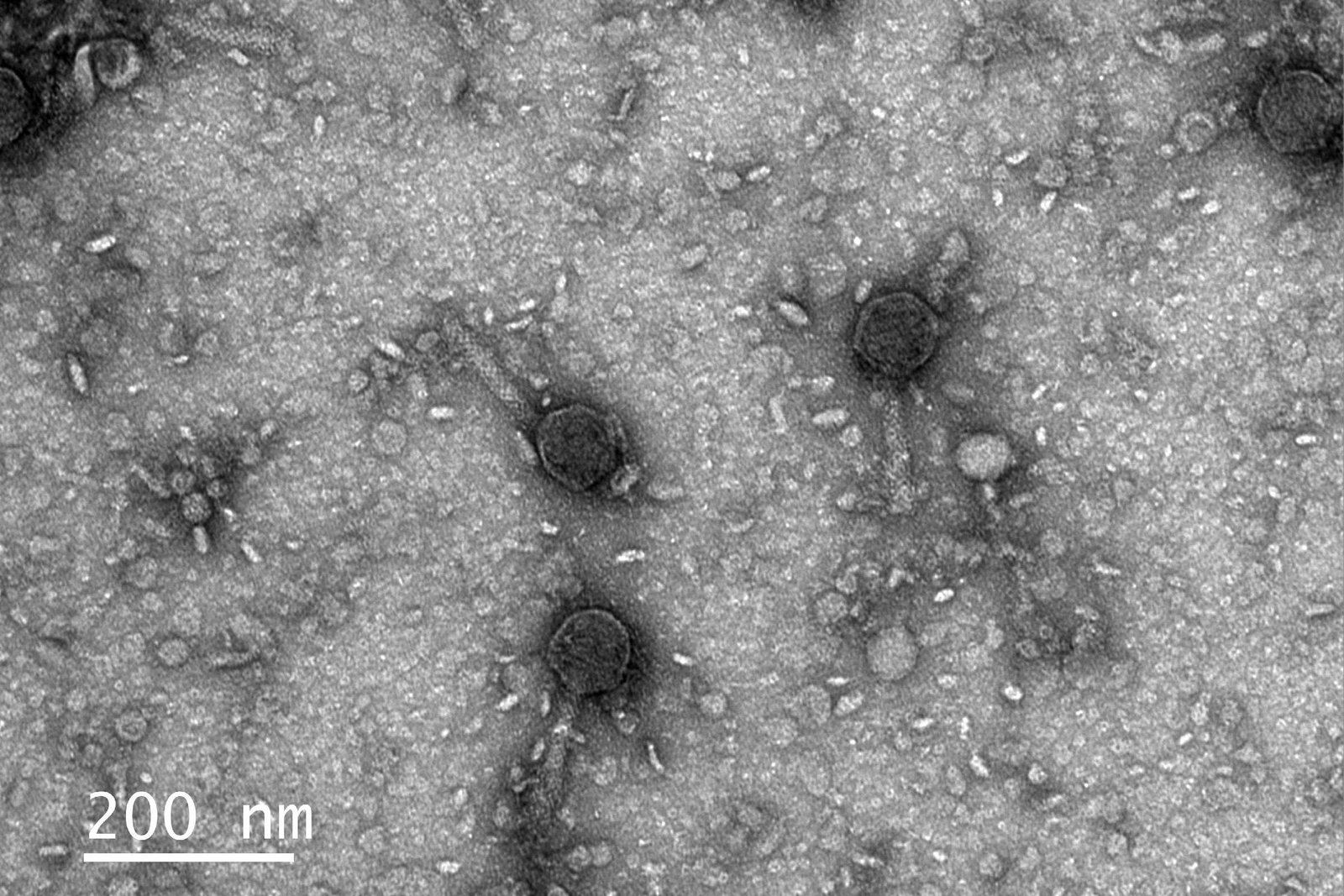 Imagem em escala nanométrica mostra múltiplos bacteriófagos com cabeças hexagonais e caudas longas sobre uma superfície granular. Escala indica 200 nanômetros.