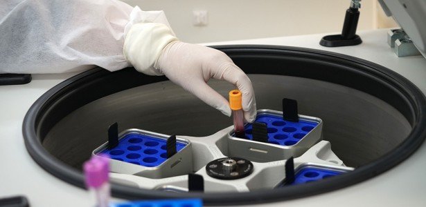 Marcadores no sangue podem prever eficácia de imunoterapia contra melanoma avançado