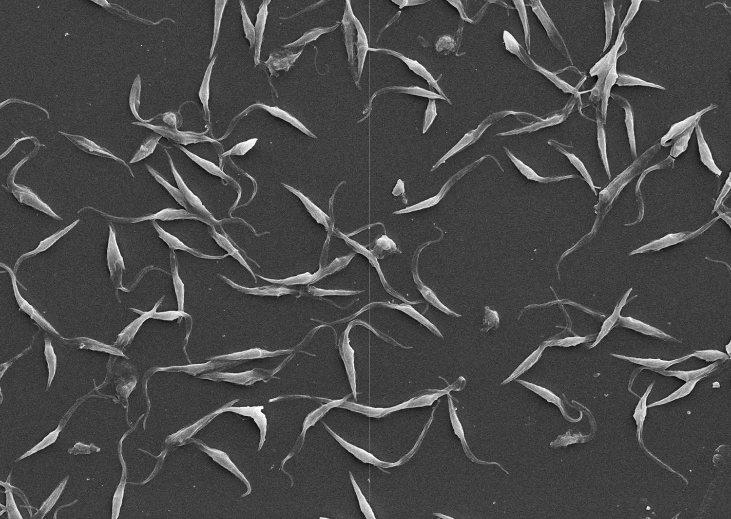 Proteína pouco conhecida é potencial alvo contra a doença de Chagas